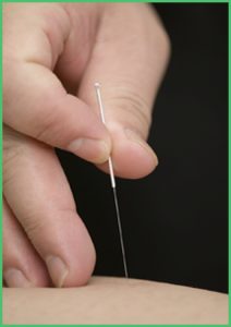 Dry Needle